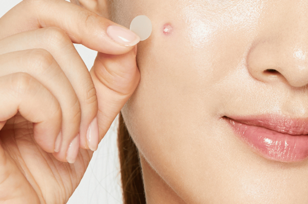 What Are Pimple Patches? – Their Benefits, Uses, & Side Effects